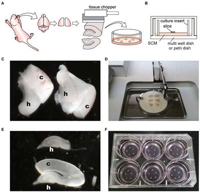 Ex vivo analysis platforms for monitoring amyloid precursor protein cleavage